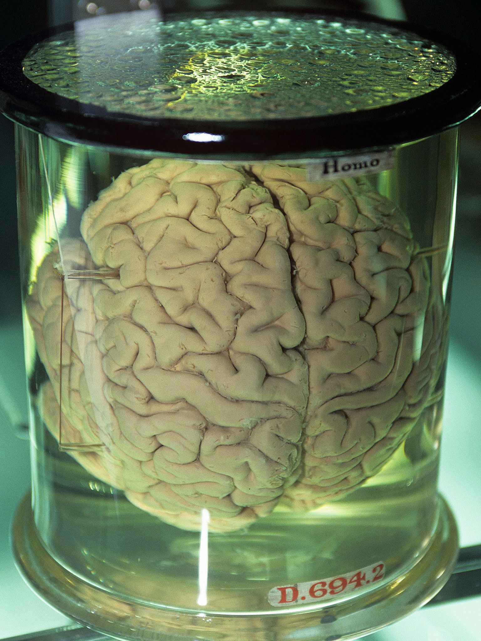 brain-in-jar